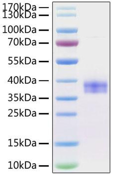 Recombinant Mouse Siglec-15/CD33L3 Protein (RPCB0936)