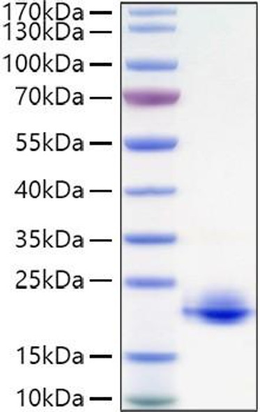 Recombinant Human Myelin oligodendrocyte glycoprotein/MOFG Protein (RPCB0976)