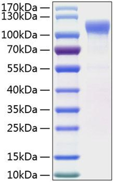 Recombinant Human LRRC4 Protein (RPCB1009)