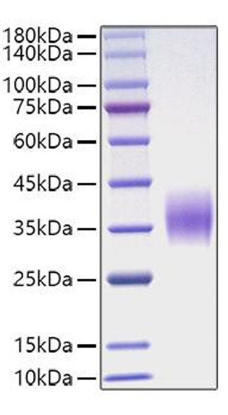 Recombinant Mouse Oncostatin-M/OSM Protein (RPCB1026)