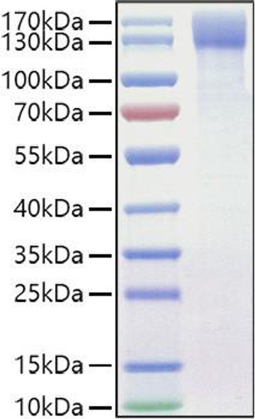 Recombinant Mouse OSMR/IL-31RB Protein (RPCB1042)