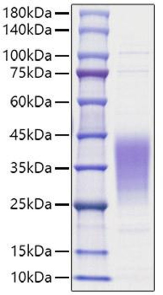 Recombinant Human Leukemia inhibitory factor/LIF Protein (RPCB1058)