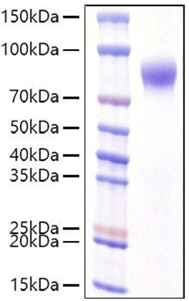 Recombinant Human IFNAR1 Protein (RPCB1066)