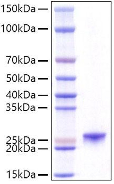Recombinant Mouse Prolactin/PRL Protein (RPCB1094)