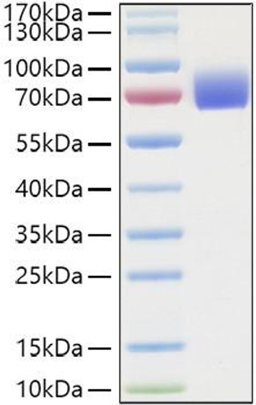 Recombinant Human IFNAR2 Protein (RPCB1111)