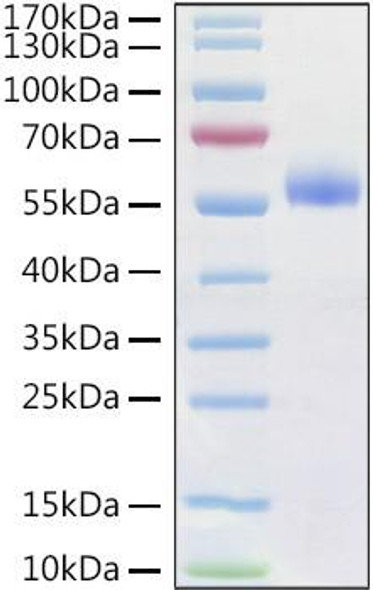Recombinant Human Frizzled-4/FZD4/CD344 Protein (RPCB1146)