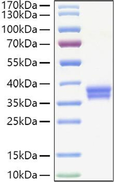 Recombinant Human VSIG3/IgSF11 Protein (RPCB1164) Recombinant Human VSIG3/IgSF11 Protein (RPCB1164)