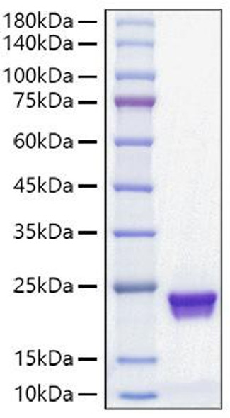 Recombinant Mouse MUP-1 Protein (RPCB1175)