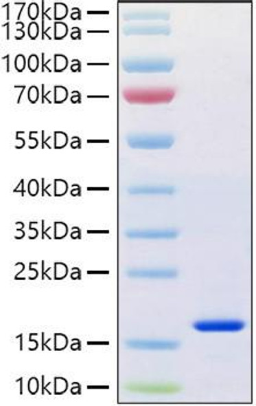Recombinant Human REG-4 Protein (RPCB1238)
