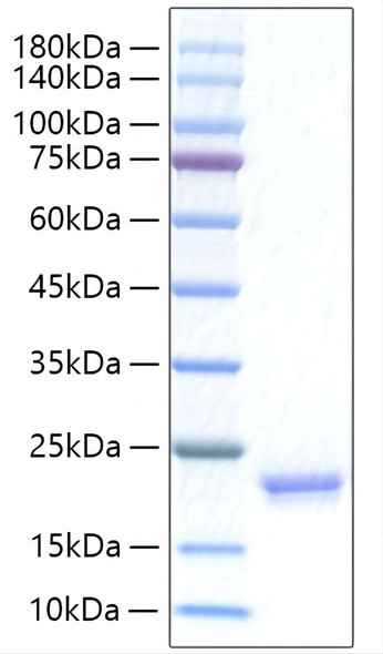 Recombinant Human IFN-alpha I/IFN17 Protein (RPCB1320)