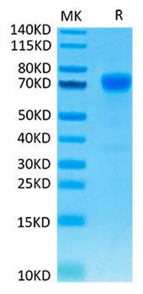 Recombinant Human B7-H1/PD-L1/CD274 Protein (RPCB1348)