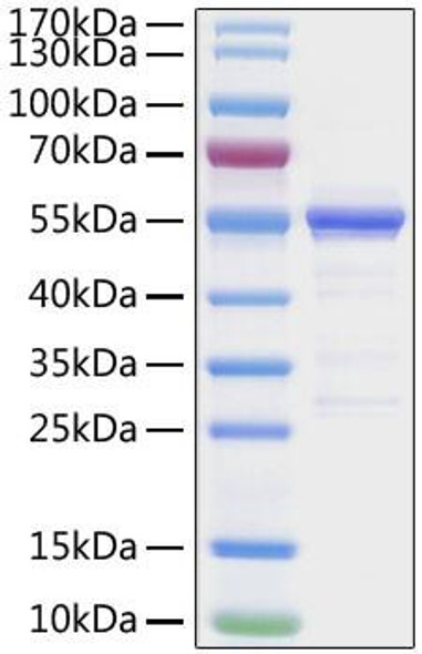 Recombinant SARS-CoV-2 Nucleocapsid(G335A) Protein (RPCB1358)