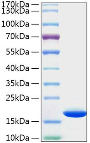 Recombinant Human Cyclophilin B/PPIase B/PPIB Protein (RPCB1368)