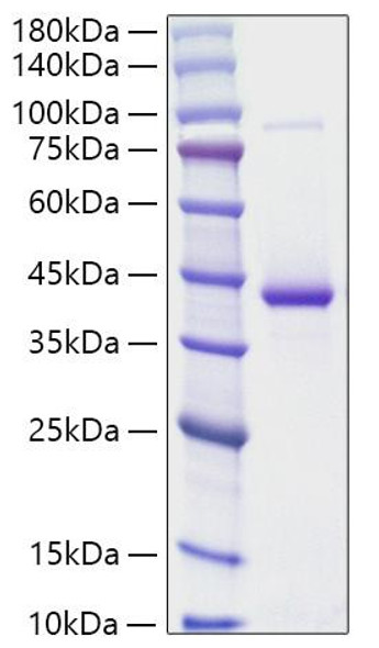 Recombinant Human RETN Protein (RPCB1370)