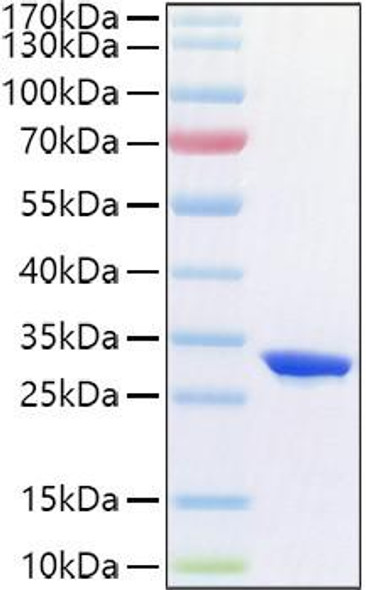 Recombinant Human Complement factor D/CFD Protein (RPCB1380)