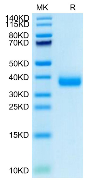 Recombinant SARS-CoV-2 Spike RBD(B.1.1.529/Omicron)  Protein (RPCB1394)