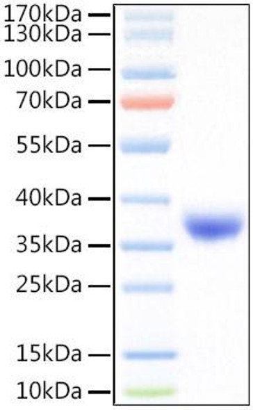 Recombinant SARS-COV-2 Spike RBD(L452R,T478K)  Protein (RPCB1410)