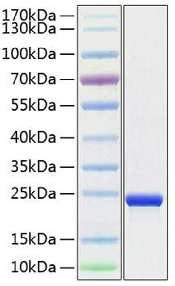 Recombinant Human TMPO Protein (RPCB1420)