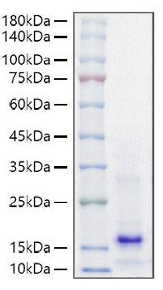 Recombinant Mouse Parathormone/PTH Protein (RPCB1462)