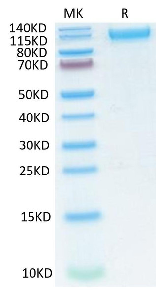 Recombinant SARS-COV-2 Spike S1 (N501Y,K417N,E484K) Protein (RPCB1482)