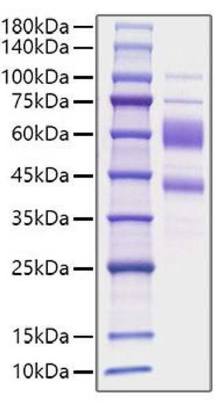 Recombinant Human IL-9 Protein (RPCB1499) Recombinant Human IL-9 Protein (RPCB1499)