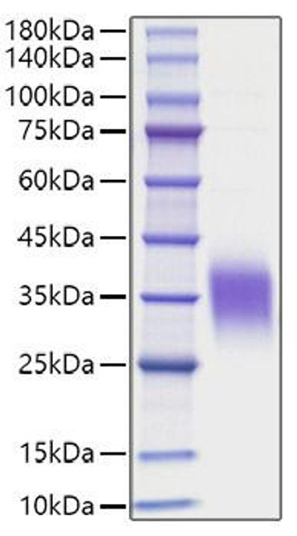 Recombinant Human IL-9 Protein (RPCB1513) Recombinant Human IL-9 Protein (RPCB1513)