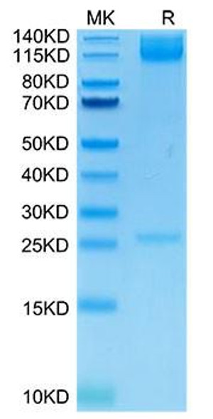Recombinant Human Integrin alpha 5 beta 1 (ITGA5&ITGB1) Heterodimer Protein (RPCB1530)