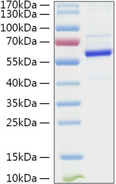 Recombinant Human TET2 Protein (RPCB1536)
