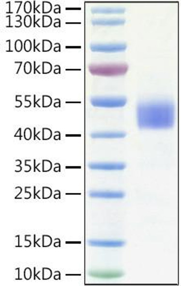 Recombinant Human IGFBP-3 Protein (RPCB1541)