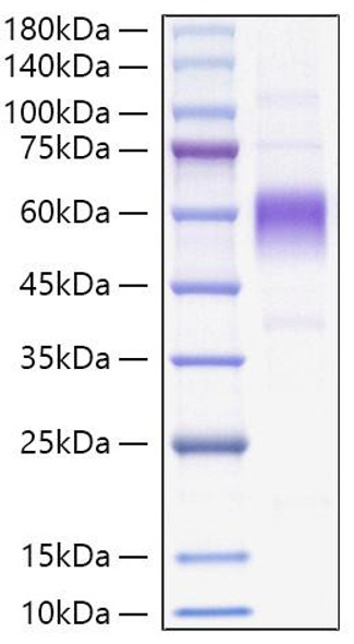 Recombinant Monkeypox virus B16R Protein (RPCB1636)