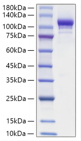 Recombinant Mouse Autotaxin/E-NPP2 Protein (RPCB1652)