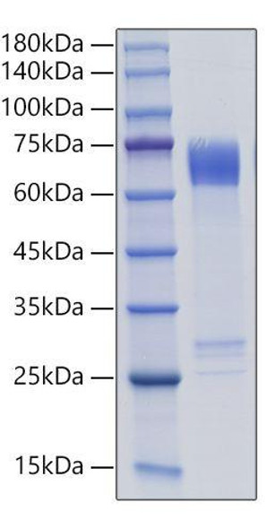 Recombinant Human MMP-8 Protein (RPCB1673)
