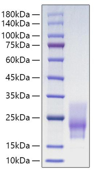 Recombinant Human CD63 Protein (RPCB1683)