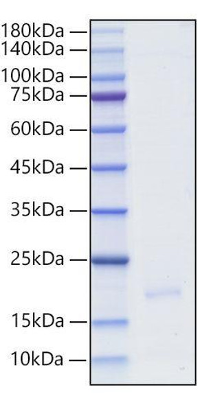 Recombinant Human IFN-alpha WA/ IFNA16 Protein (RPCB1687)