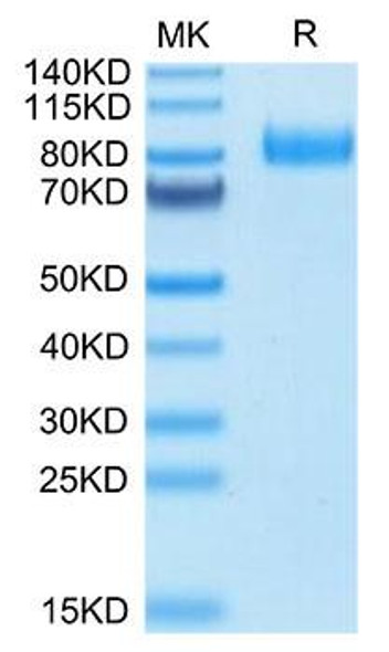Recombinant Human B7-H7/HHLA2 Protein (RPCB1691)