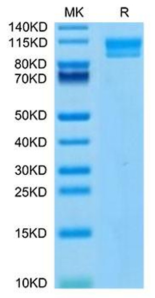 Recombinant Human IL-17Rc Protein (RPCB1692)