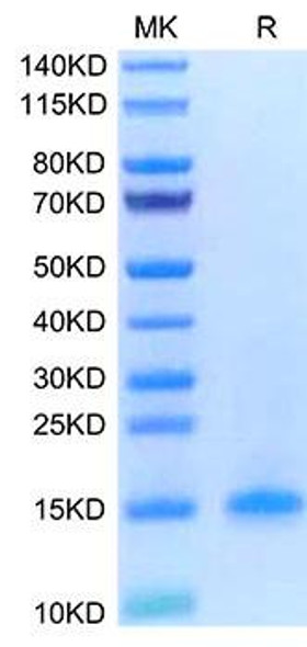 Recombinant Human CD3 delta Protein (RPCB1712)
