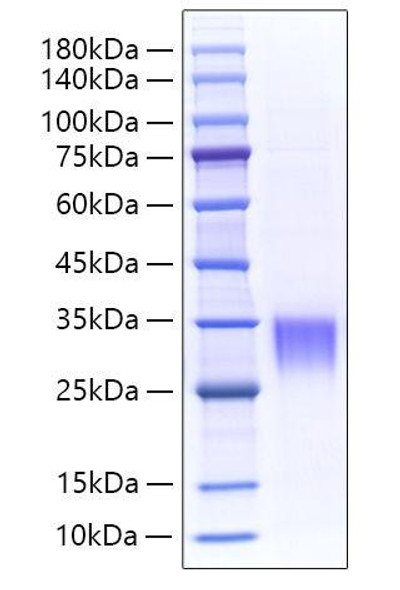 Recombinant Mouse Asprosin/Fibrillin-1/FBN1 Protein (RPCB1729)
