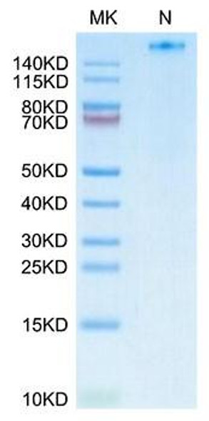 Recombinant Human NY-ESO-1(HLA-A*02:01) Tetramer Protein (RPCB1785)
