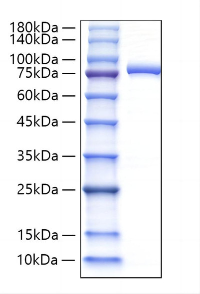 Recombinant Human Lactotransferrin/LTF Protein (RPCB1787)