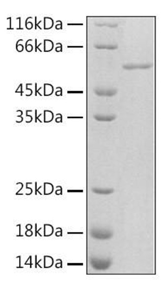 Recombinant Rat Serpin E1/PAI-1 Protein (RPCB1808)