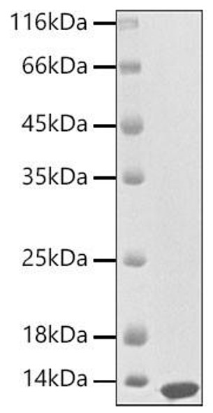 Recombinant Mouse S100-A8 Protein (RPCB1819)