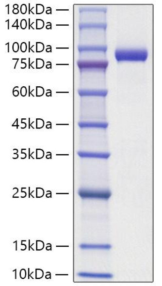 Recombinant Human IL1RAPL-2 Protein (RPCB1829)