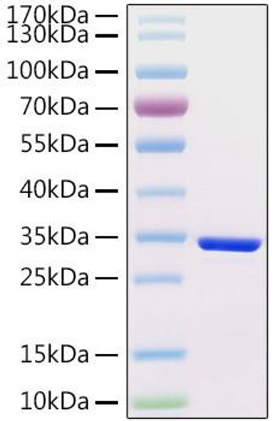 Recombinant Human Choriogonadotropin subunit beta 3/CGB3 Protein (RPCB1841)