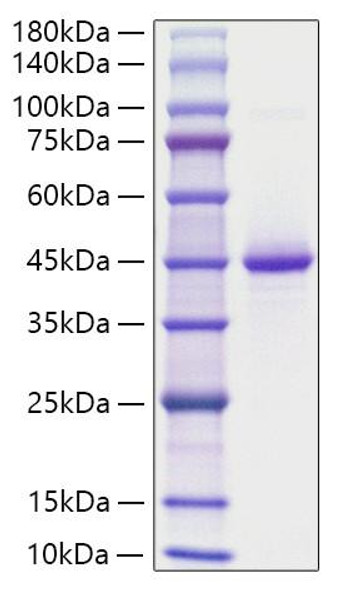 Recombinant Human Neurogranin/NRGN Protein (RPCB1852)
