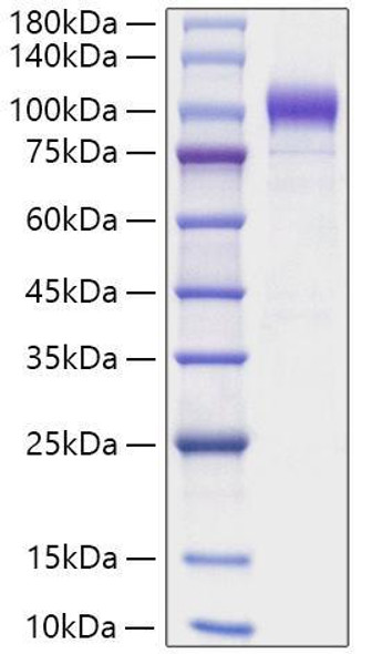 Recombinant Human Semaphorin-6A/SEMA6A Protein (RPCB1867)