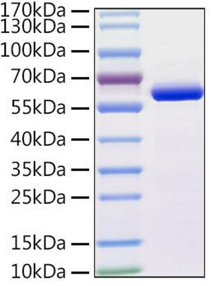 Recombinant Human TUBB4A Protein (RPCB1873)