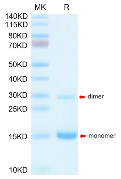 Recombinant Mouse S100-A9 Protein (RPCB1882)