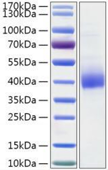 Recombinant Human Gamma-glutamyl hydrolase/GGH Protein (RPCB1939)