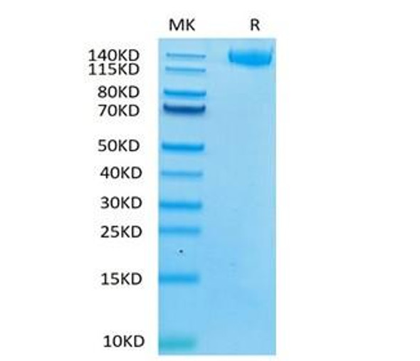 Recombinant Human Leukemia inhibitory factor receptor/LIF-R/CD118 Protein (RPCB2144)
